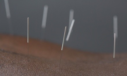 Acupuncture Sessions with Nutrition counseling at Health First Wellness Center (Up to 85% Off). 