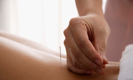 Up to 27% Off on Acupuncture Services at Align Sports Chiropractic & Health Center