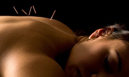 Consultation & 30-Minute Acupuncture Treatment at Total Healing Wellness (Up to 84% Off). Two Options Available.