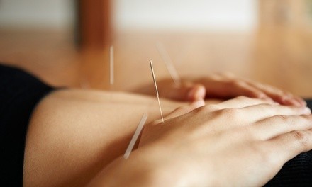 Dry Needling at Gold Medal Physical Therapy (Up to 43% Off).