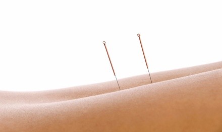 Two or Four Acupuncture Treatments with Exam and X-rays at Oliver Chiropractic and Acupuncture (90% Off)