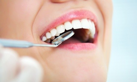 Up to 42% Off on Denture Services at Todays Dental @ Cayce