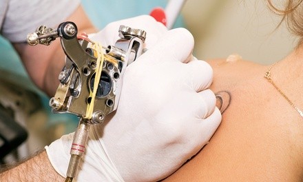 Three Laser Tattoo-Removal Sessions at Cirius Advanced Laser (Up to 76% Off). Four Options Available. 