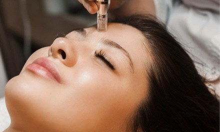 Up to 75% Off on Micro-Needling at Bougie Dame Beauty