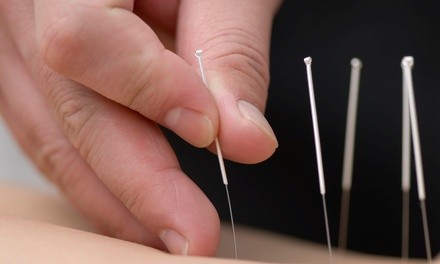 Up to 70% Off on Acupuncture Services at Michael D. Mathews L.ac