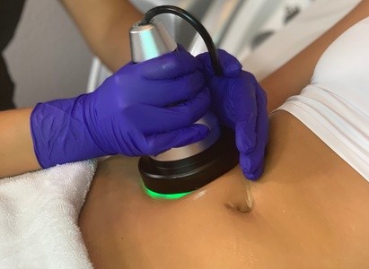 Up to 66% Off on Cavitation at Cryo Recovery Lounge