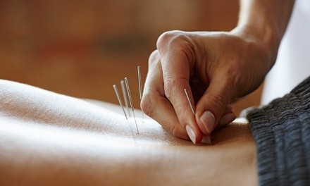 Up to 60% Off on Acupuncture Services at Ryon Acu Clinic