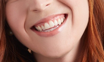 Deep Teeth Cleaning at Heather Ridge Dentistry & Orthodontics (Up to 65% Off)