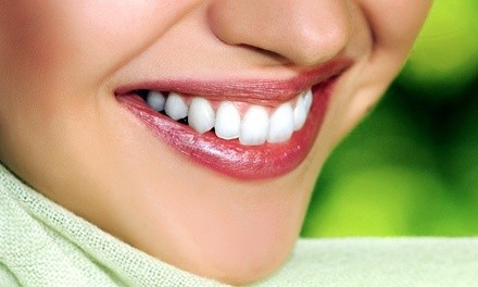 Up to 50% Off on Teeth Whitening - Traditional at Shine Bright Teeth Whitening