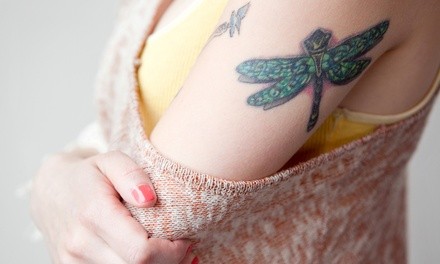 Three Laser Tattoo-Removal Sessions at Louisville Laser (Up to 60% Off). Four Options Available.