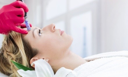 One or Three IPL Photofacial Treatments at South Florida Skin Care Systems (Up to 79% Off)