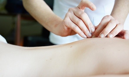 One or Two 90-Minute Custom Massages with Acupuncture and Add-Ons at BJ Healthcare Massage & Spa (Up to 72% Off)