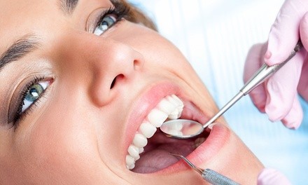 Up to 40% Off on Teeth Whitening - Traditional at DiamondBaby Gems