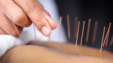 Up to 31% Off on Massage - Acupressure at Iron Hands Sports Massage And Rehab