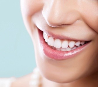 Up to 50% Off on Teeth Whitening - In-Office - Non-Branded at Beauty Balance Esthetics