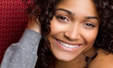 Dental Exam, X-ray&Cleaning with Option of Take-Home Whitening Kit at Castlebury Dental in Eagle (Up to 85% Off)