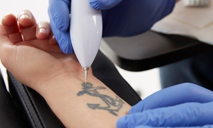 Up to 50% Off on Tattoo Removal at BrigiBeauty llc.