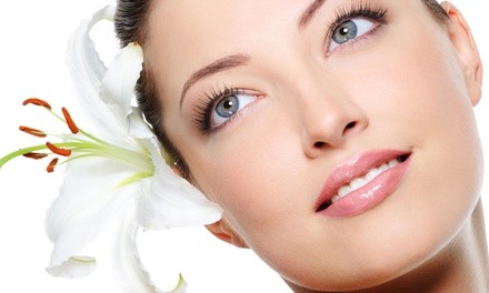 Microdermabrasion or One, Three, or Five Microdermabrasions with Light Peel at Spa Bella Medispa (Up to 66% Off)