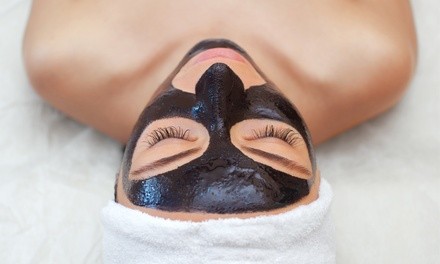 One or Two Carbon Laser Facial Peels at Glow Medical Aesthetics (Up to 38% Off)