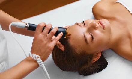 One or Two Intense Pulsed Light Photofacials at Profound MedSpa (Up to 72% Off)