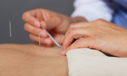 One Initial Consultation and Three, Five, or Ten Acupuncture Treatments at Acupuncture & Injury (Up to 66% Off)