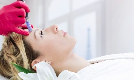 One or Two Microneedling Treatments at Northshore Health and Beauty (Up to 34% Off)