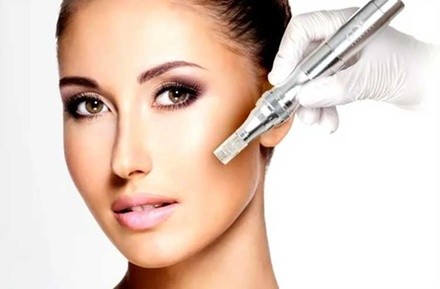 Up to 64% Off on Micro-Needling at Carissa Skin Care Solutions