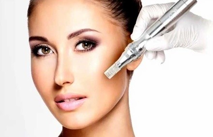 One, Two, or Three 40-Minute Microneedling Treatments with Hyaluronic Acid at The Skiin Boutique (Up to 54% Off)