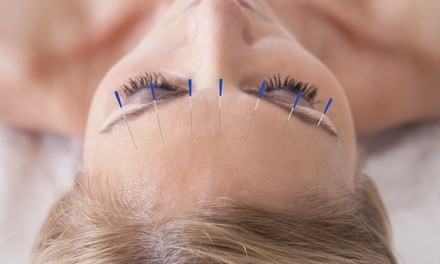 Up to 32% Off on Acupuncture Services at Pensacola Microneedling