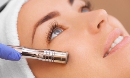 One Microdermabrasion Treatment w/ Optional Facial & Cranial or Decollete Massage at Cale Salon (Up to 58% Off)