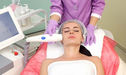 One, Two, or Three IPL Photofacials at Laser Fit (Up to 84% Off). Four Options Available.