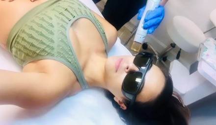 Up to 52% Off on Laser Hair Removal at A New You Aesthetics LLC