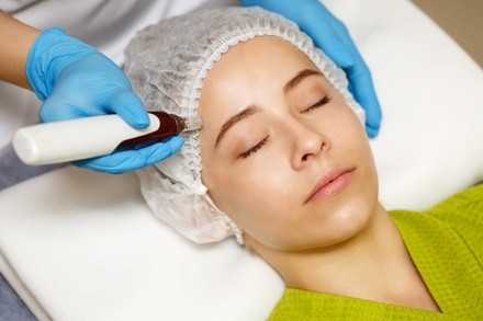 $179 for One Microneedling Scar Treatment with Peel at Wicked Med Spa ($425 Value)