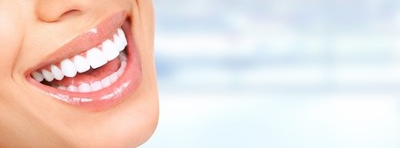 Up to 30% Off on Teeth Whitening - Traditional at Daisy Luxxe