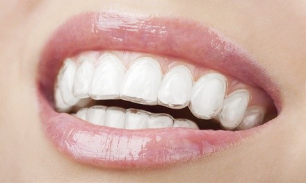 $49 for $1,100 Toward Invisalign Treatment at River Run Dental