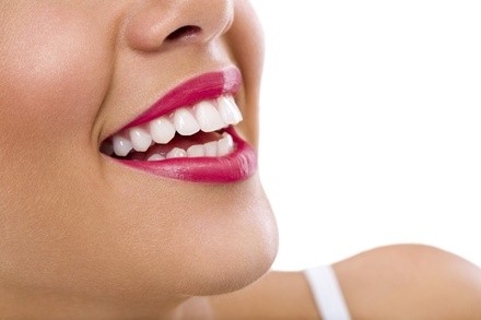 Dental Exam, Cleaning, and X-Ray with Optional Smile Analysis at Hillcrest Dental Care (Up to 85% Off)