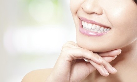 Up to 85% Off Dental Exam & Whitening at Shirazi DDS - Eldridge