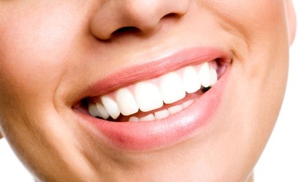 30- or 60-Minute Teeth-Whitening Treatment, or One or Two Tooth Gems at Vanity Beauty & Wax (Up to 50% Off)