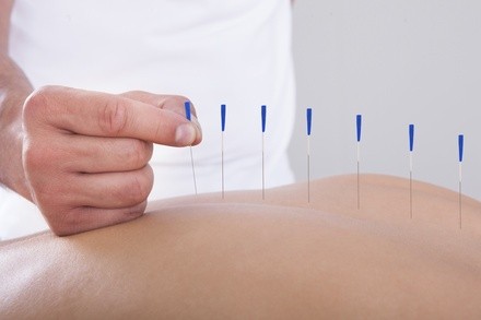 Up to 50% Off on Acupuncture Services at Inner Harmony Acupuncture