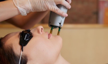 Up to 76% Off on IPL Photo Facial at Leegerem Advance Aesthetic Techniques