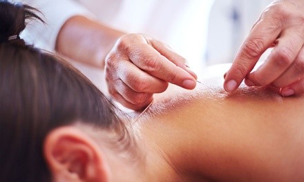 $58 for 60-Minute Acupuncture Initial Consultation and Treatment at Emanate Balance ($120 Value)