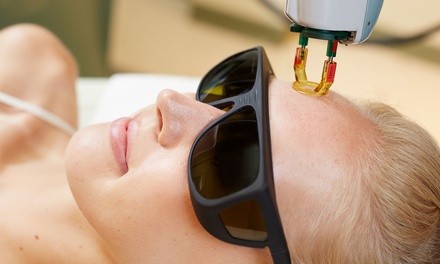 One, Two, or Three YAG Ablative Laser Skin-Resurfacing Sessions at Novo Medical Aesthetics (Up to 63% Off)