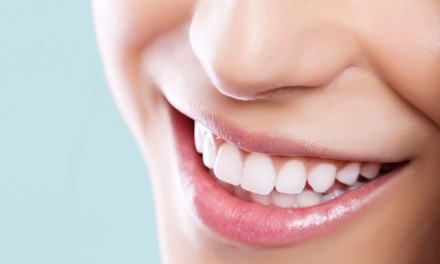 $89 for a Picture-Perfect Teeth Whitening Session at Skin Fitness ($249 Value)