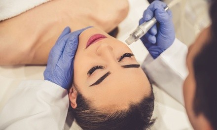 Season Facial or Diamond Microdermabrasion Treatment at Re Fresh Beauty Bar (Up to 41% Off)