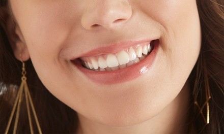 Up to 79% Off on Teeth Whitening - In-Office - Non-Branded at De Na S Brightening Teeth Whitening Studio