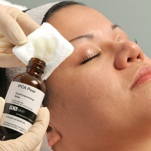 Up to 52% Off on Facial - Chemical Peel at Most Wanted Beauty