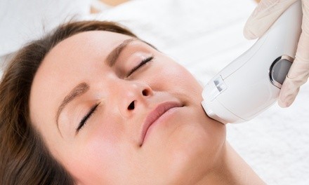 One or Two IPL Laser Treatments at Novo Medical Aesthetics (Up to 80% Off)