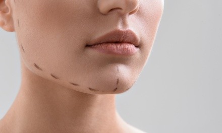 $264.50 for One Under-Chin Fat-Melting Mesotherapy Treatment Session at Rodriguez Rejuvenation ($959 Value) 