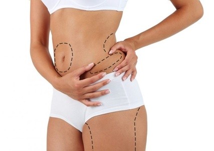 Up to 71% Off on Cavitation at Fifty Shades Of White