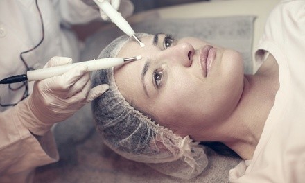 Plasma Fibroblast Skin-Tightening Sessions at Ahtemu (Up to 64% Off) 11 Options Available.